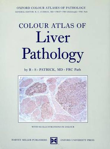 Cover image for Colour Atlas of Liver Pathology