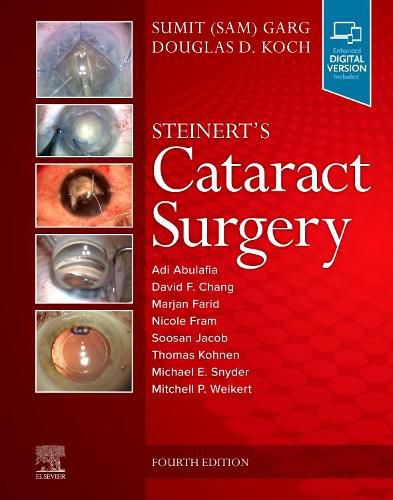 Cover image for Steinert's Cataract Surgery