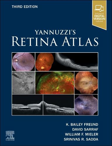 Cover image for Yannuzzi's Retina Atlas
