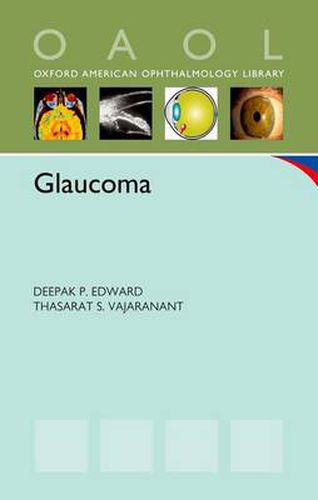 Cover image for Glaucoma