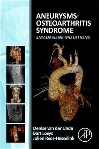 Cover image for Aneurysms-Osteoarthritis Syndrome: SMAD3 Gene Mutations