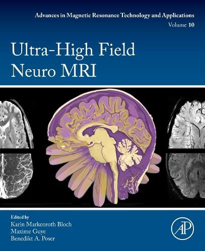 Cover image for Ultra-High Field Neuro MRI: Volume 10