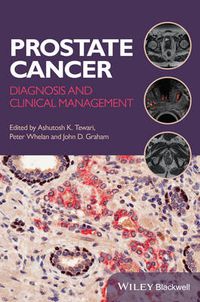 Cover image for Prostate Cancer: Diagnosis and Clinical Management