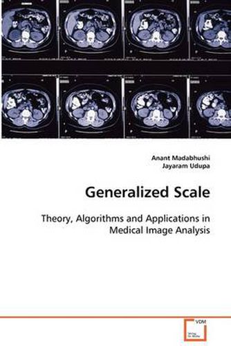 Cover image for Generalized Scale