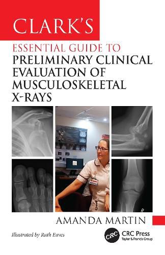 Cover image for Clark's Essential Guide to Preliminary Clinical Evaluation of Musculoskeletal X-rays