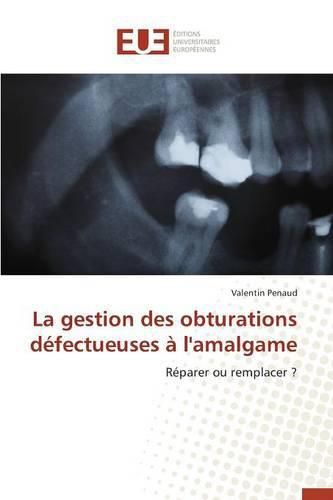 Cover image for La Gestion Des Obturations Defectueuses A l'Amalgame