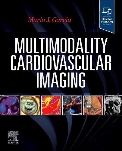 Cover image for Multimodality Cardiovascular Imaging