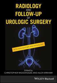 Cover image for Radiology and Follow-up of Urologic Surgery