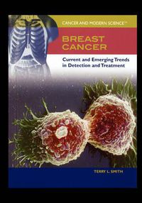 Cover image for Breast Cancer: Current and Emerging Trends in Detection and Treatment