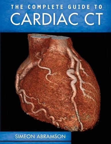 Cover image for The Complete Guide To Cardiac CT (PB)