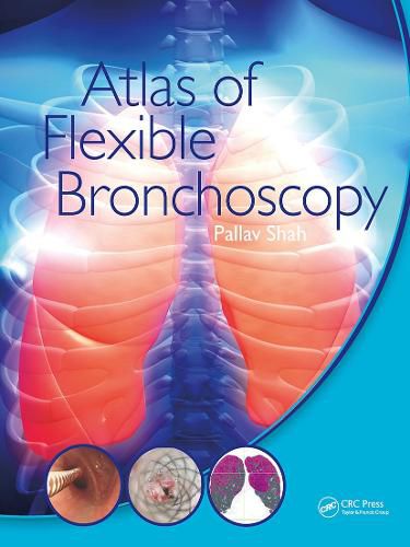 Cover image for Atlas of Flexible Bronchoscopy