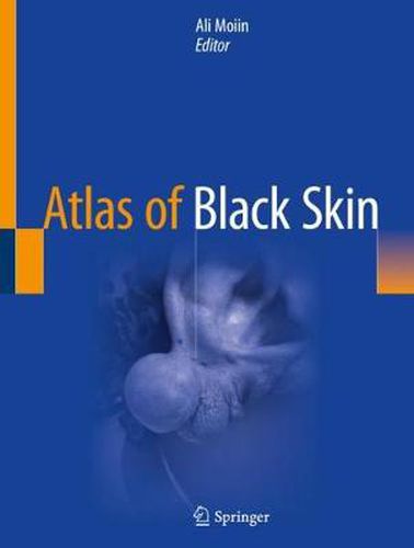 Cover image for Atlas of Black Skin