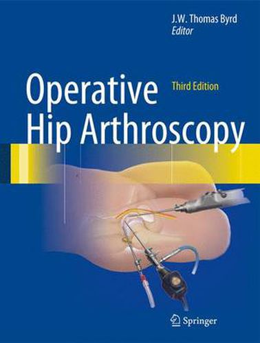 Cover image for Operative Hip Arthroscopy