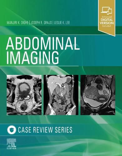 Cover image for Abdominal Imaging: Case Review Series