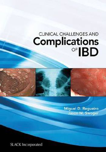 Cover image for Clinical Challenges and Complications of IBD