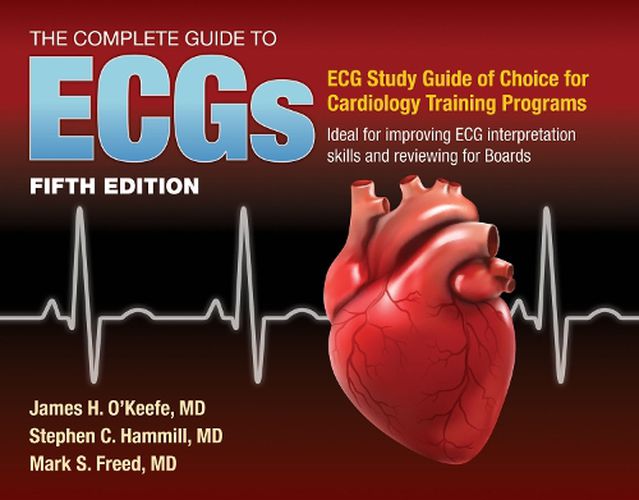 Cover image for The Complete Guide to ECGs: A Comprehensive Study Guide to Improve ECG Interpretation Skills