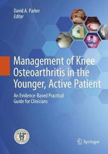 Cover image for Management of Knee Osteoarthritis in the Younger, Active Patient: An Evidence-Based Practical Guide for Clinicians