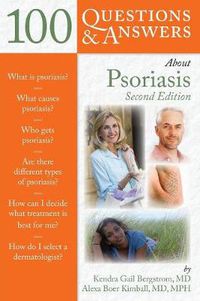 Cover image for 100 Questions  &  Answers About Psoriasis