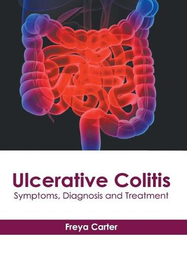 Cover image for Ulcerative Colitis: Symptoms, Diagnosis and Treatment