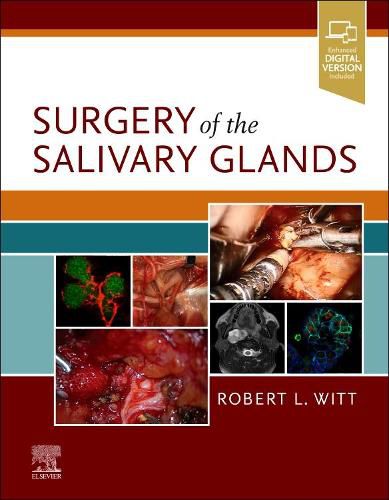 Cover image for Surgery of the Salivary Glands