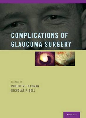 Cover image for Complications of Glaucoma Surgery