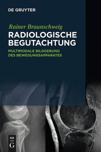 Cover image for Radiologische Begutachtung: Multimodale Bildgebung Des Bewegungsapparates