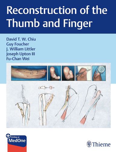 Cover image for Reconstruction of the Thumb and Finger