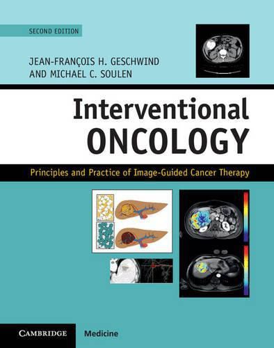 Cover image for Interventional Oncology: Principles and Practice of Image-Guided Cancer Therapy