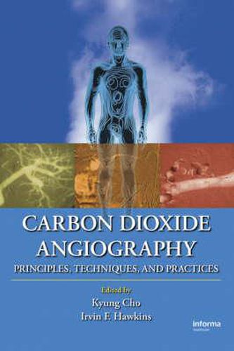 Cover image for Carbon Dioxide Angiography: Principles, Techniques, and Practices