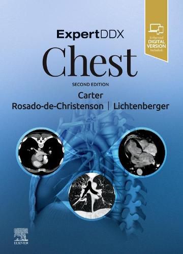 Cover image for ExpertDDx: Chest