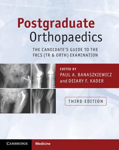 Cover image for Postgraduate Orthopaedics: The Candidate's Guide to the FRCS (Tr & Orth) Examination