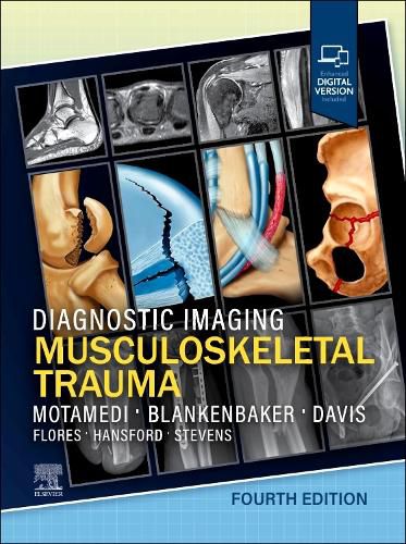 Cover image for Diagnostic Imaging: Musculoskeletal Trauma