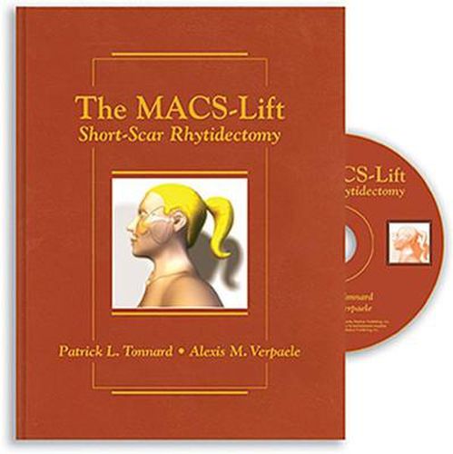 Cover image for The MACS-Lift: Short-Scar Rhytidectomy