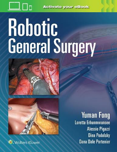 Cover image for Robotic General Surgery