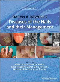 Cover image for Baran & Dawber's Diseases of the Nails and their Management