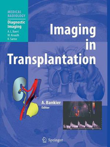 Cover image for Imaging in Transplantation