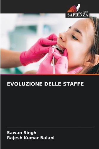 Cover image for Evoluzione Delle Staffe