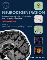 Cover image for Neurodegeneration - The Molecular Pathology of Dementia and Movement Disorders 2e