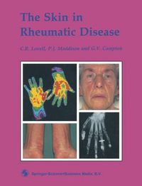 Cover image for The Skin in Rheumatic Disease