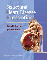 Cover image for Structural Heart Disease Interventions