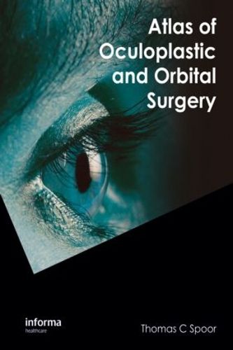 Cover image for Atlas of Oculoplastic and Orbital Surgery