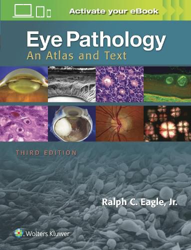 Cover image for Eye Pathology: An Atlas and Text