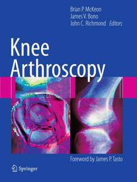 Cover image for Knee Arthroscopy