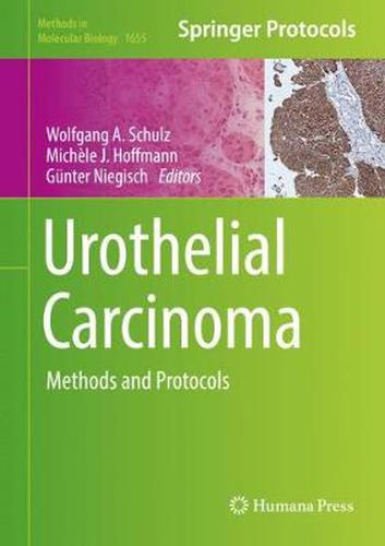 Urothelial Carcinoma: Methods and Protocols