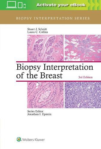 Cover image for Biopsy Interpretation of the Breast