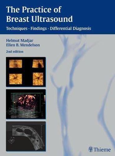 Cover image for The Practice of Breast Ultrasound: Techniques, Findings, Differential Diagnosis