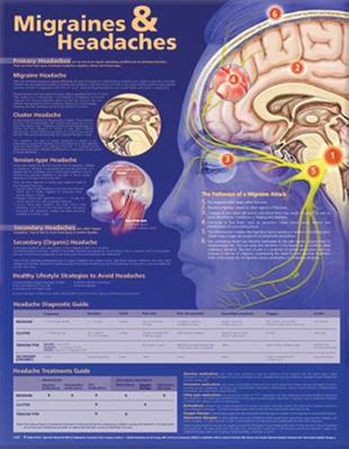 Cover image for Migraines and Headaches Anatomical Chart