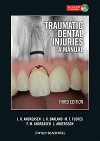 Cover image for Traumatic Dental Injuries: A Manual