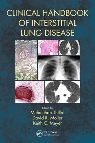 Cover image for Clinical Handbook of Interstitial Lung Disease