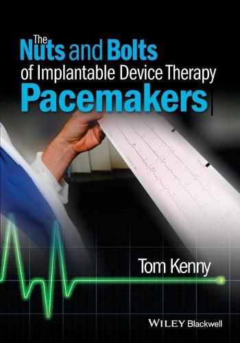 Cover image for The Nuts and Bolts of Implantable Device Therapy - Pacemakers